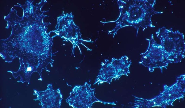 Researchers discover new inhibitor drug combination for rare form of cancer